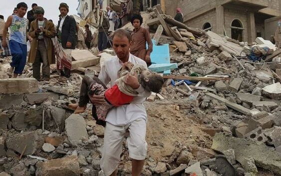 Шокирующая статистика: 2800 дней агрессии против Йемена; мученическая гибель более 4 тысяч детей